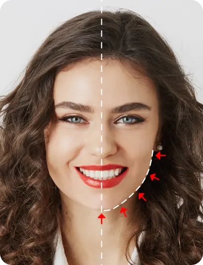 Before after image of a girl getting a chin lift using AI
